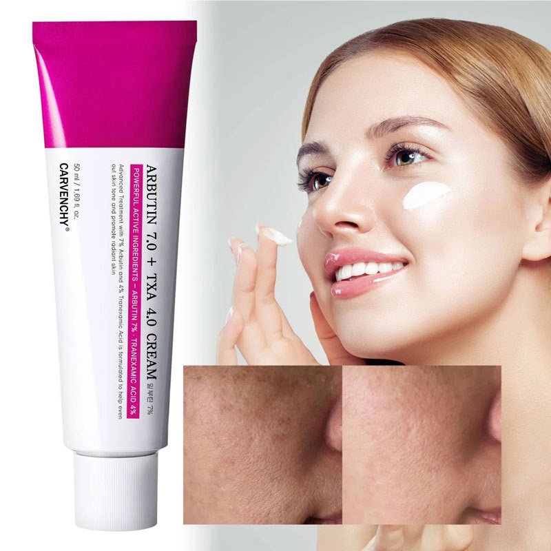 7% Arbutin + 4% TXA Tone Cream — 3 Pack